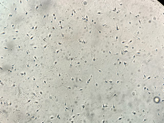 View at human sperm under microscope in lab
