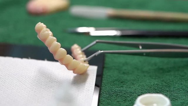 New Prosthetic Zirconium Denture on Table of Dental Laboratory Holded With Pincers