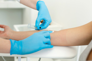 a nurse in the clinic inserts a catheter into a vein for blood testing for a young girl