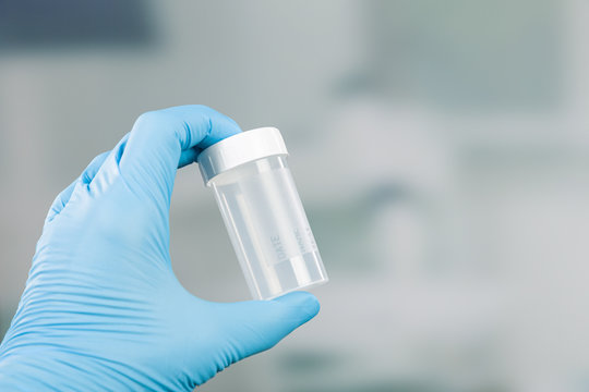 Hand in blue medical gloves holds a medical probe container