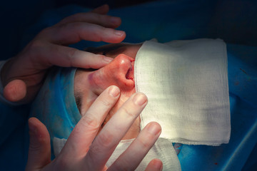 Surgeon and his assistant performing cosmetic surgery on nose in hospital operating room. Nose...