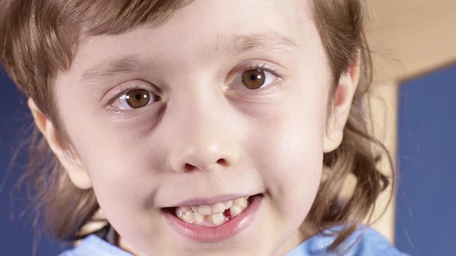 Smiling boy of six years old with bumpy teeth. Closeup