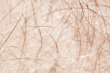 Hair with skin on the human leg close-up, macro