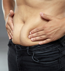 Fototapeta premium Fat woman abdomen