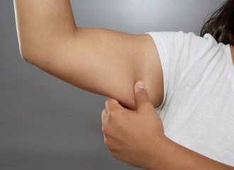 Fat woman's arm