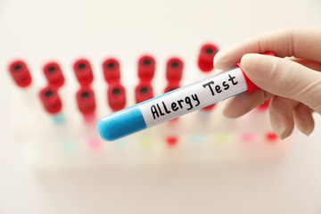 Fototapeta premium Doctor holding tube with label ALLERGY TEST over table, closeup