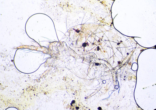 Spider mite under the microscope