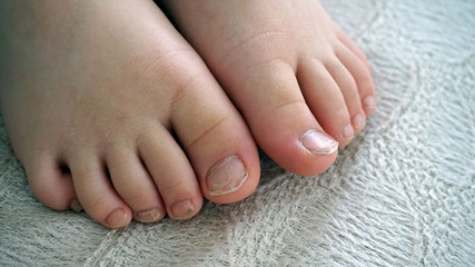 baby right foot, baby toes, baby toenails, little baby feet and little fingers,