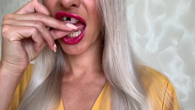 A woman with a broken front tooth removes and puts on a microprosthesis. Tooth implantation.