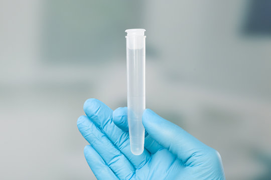 Hand in medical gloves holds a medical probe container