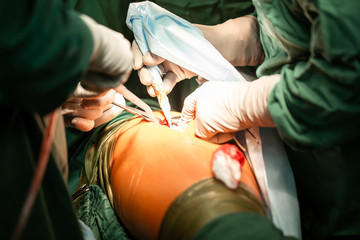 Surgical operation. Disposable electrosurgical pencil. Incision on the chest