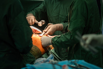modern life orthopedic problems, medical professionals concept. Hip replacement surgery in...