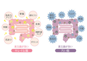 腸内環境のイメージイラスト（良い状態と悪い状態）