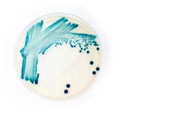 Klebsiella - bacterial cultures. White background