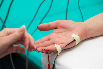 Obraz na płótnie Canvas On the hands of the patient sensors. Diagnostics through electronic devices.