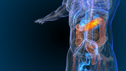 3d rendered illustration of  bowel cancer 3D illustration