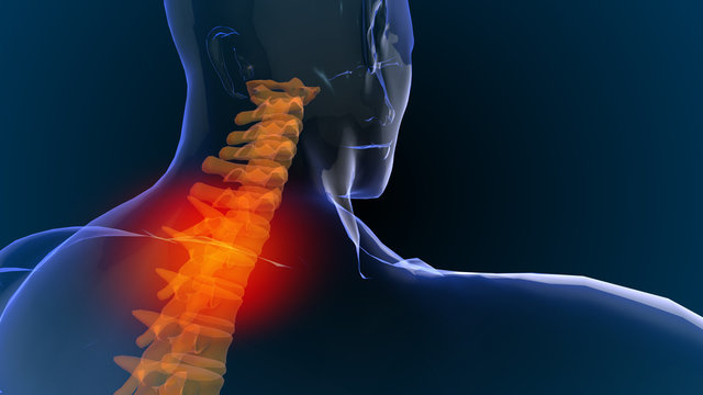 3d rendered illustration of  shoulder, back and neck pain 3D illustration