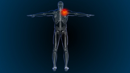 3d rendered illustration of  shoulder, back and neck pain 3D illustration