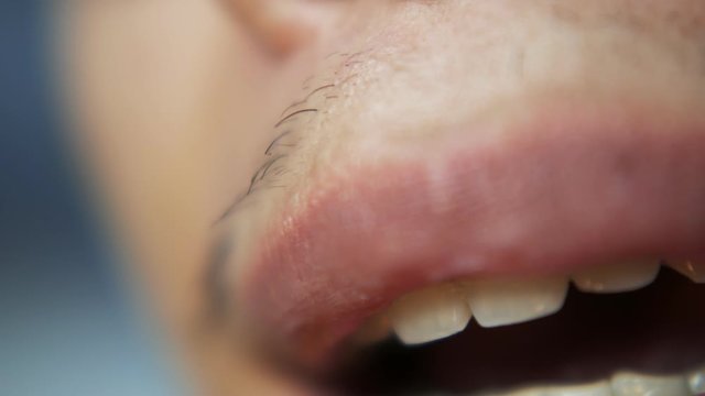 Man's mouth talking with retainer braces
