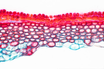 Cross sections of plant stem under microscope view show Structure of Sclerenchyma cells.