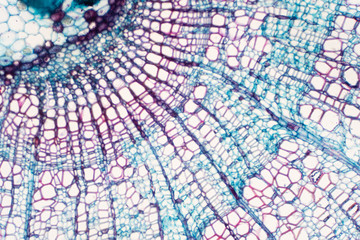 Cross section - Xylem is a type of tissue in vascular plants that transports water and some nutrients.