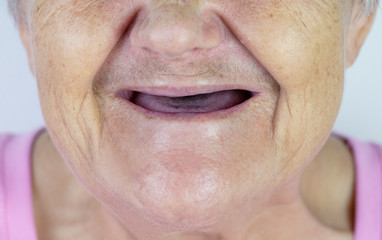Toothless mouth. An elderly woman with no teeth. Old Granny with her mouth open.