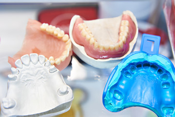 Denture molds