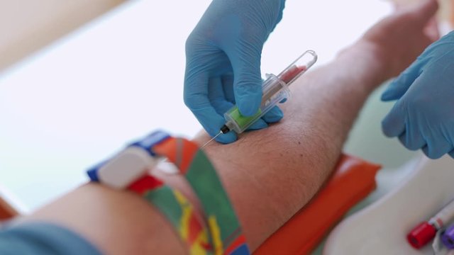 Close-up of the process of taking blood from the vein. Lab technician pricking needle syringe in the arm patient drawing blood sample for blood test.