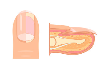 Anatomy of human finger nail. Medical diagram of the structure of the inside cross-section of the fingers. Vector infographic concept  isolated on white background