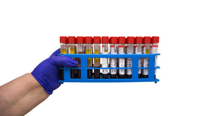 hand holds test tubes on a white background, isolate. Laboratory assistant hand holds stand with test tubes with blood samples on a white background