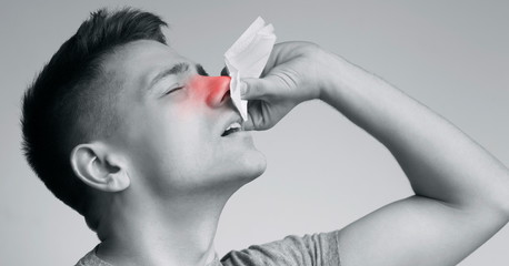 Young man suffering from nasal bleeding, stop blood with tissue