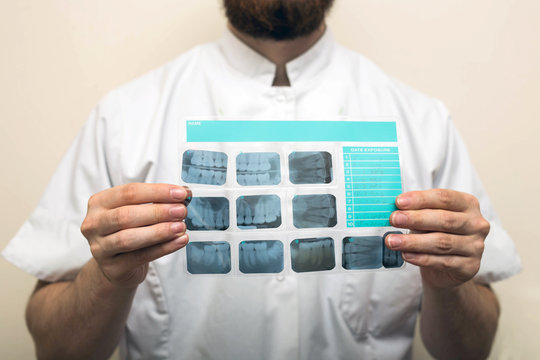 Image of male doctor or dentist holding and looking at old dental x-ray, analyzing