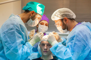 Baldness treatment. Hair transplant. Surgeons in the operating room carry out hair transplant surgery. Surgical technique that moves hair follicles from a part of the head. - obrazy, fototapety, plakaty