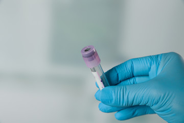 Doctor's hand with medical glove holding an empty blood tube in front of a lab