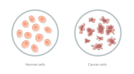 cell structure: normal and cancer