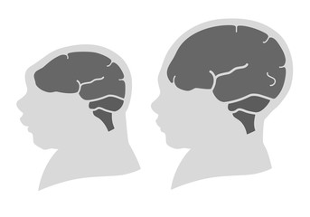 Silhouette image of the head and skull of a newborn child with a normal cranium and with microcephaly and severe microcephaly. Virus of Zika. Flat design