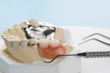 Close up, Removable partial denture (RPD.) on blue background.
