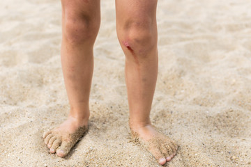 Fototapeta na wymiar Worn knees worn small child standing on the sand. The blood comes from a small wound.