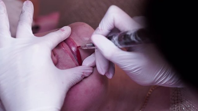 the master makes a permanent tattoo of the lips to the patient with a permanent tattoo machine