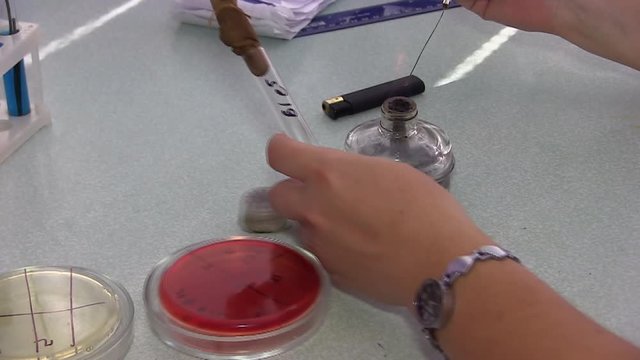  Bacteriological analysis. Laboratory. Staphylococcus Bacterium