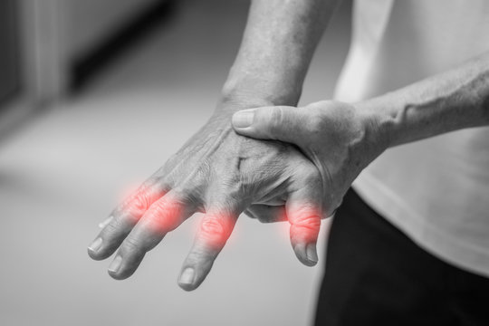 Tendinitis Overuse Hand Problems. Old Man Hand With Red Spot O Fingers As Suffer From Carpal Tunnel Syndrome. The Symptoms Of Tingling, Numbness, Weakness, Or Pain Of The Fingers And Wrist.