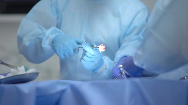 Members of surgeon team using forceps on invasive operation, hospital care