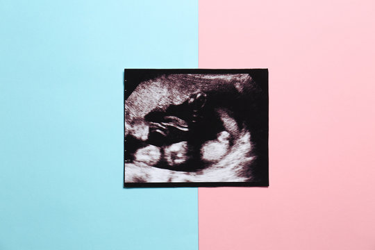 Ultrasound photo on color background, top view