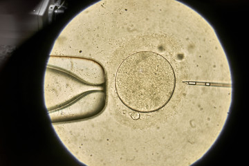 View through microscope at in vitro fertilization process
