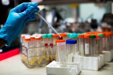 laboratory equipment pipette dropping sample into a test tube,abstract science background.