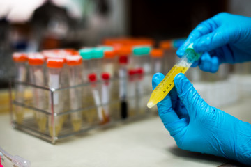 laboratory equipment pipette dropping sample into a test tube,abstract science background.