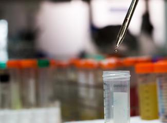 laboratory equipment pipette dropping sample into a test tube,abstract science background.