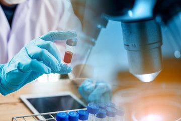 lab technician assistant analyzing a blood sample in test tube at laboratory with microscope....