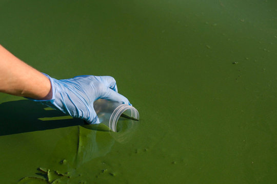 closeup of hand in medical glove taking sample of green algae in container