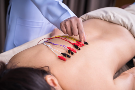 Ear electro-acupuncture - Stock Image - M745/0212 - Science Photo Library